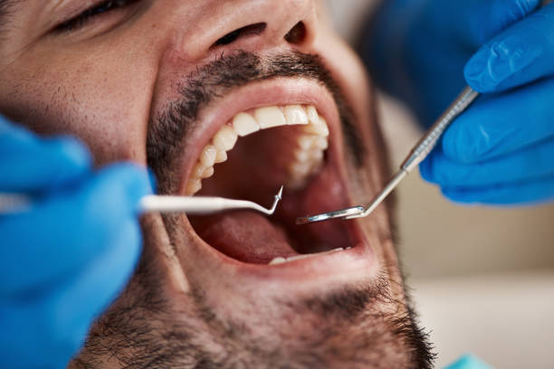 Best Chipped Tooth Repair Near Me  in Bedford Hills, NY